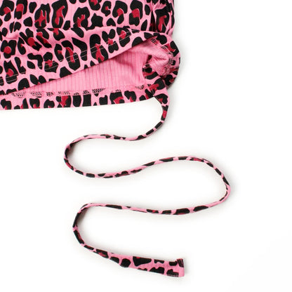 170983104