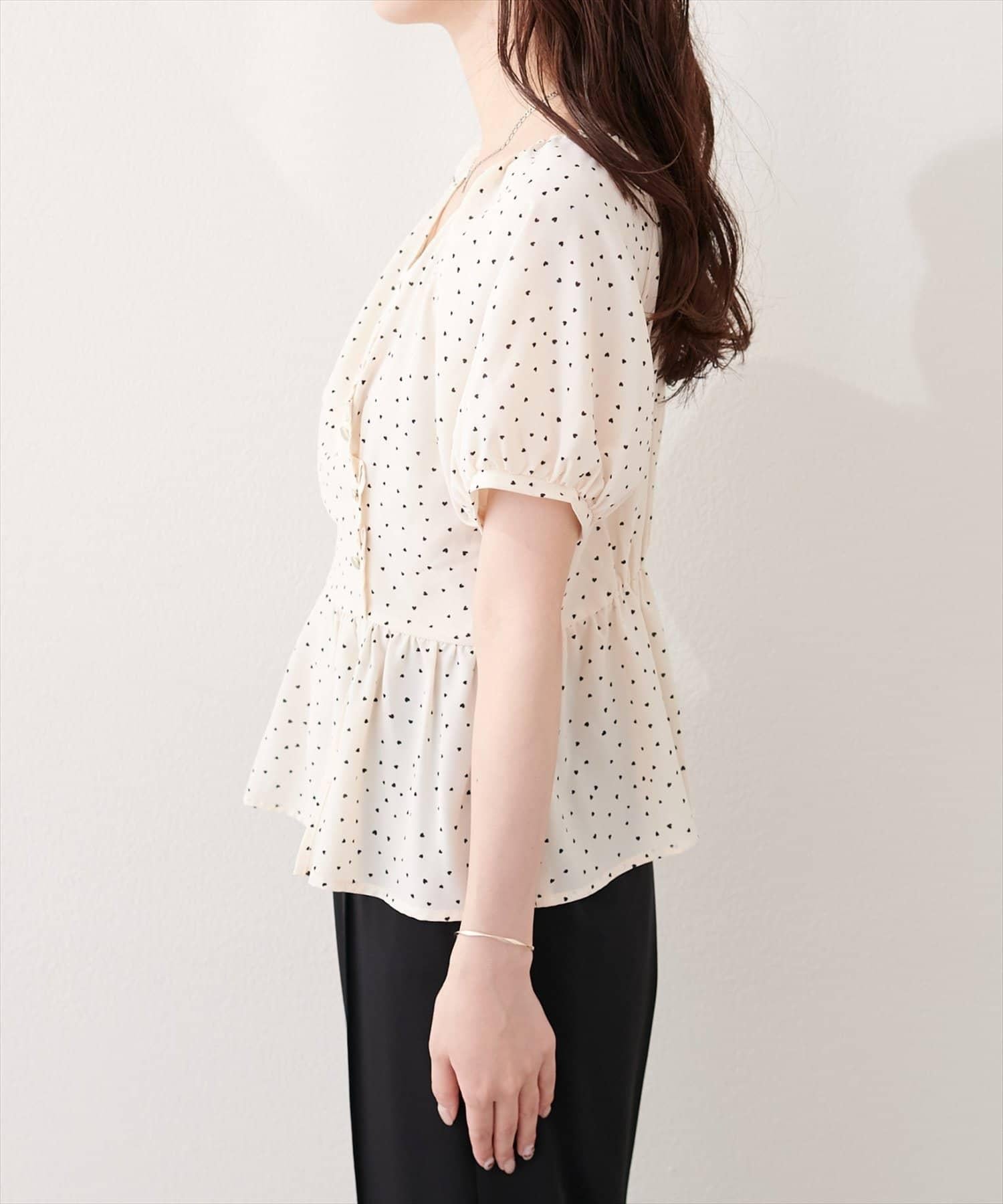 170809394